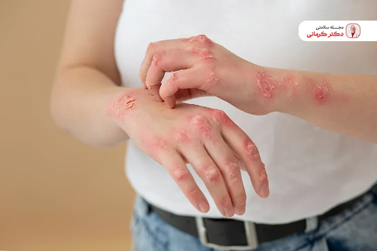 عوارض کمبود پروبیوتیک